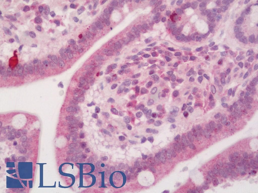IHC-plus™ ETNK2 Antibody (aa203-385)
