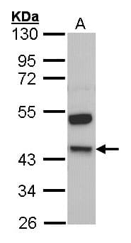 PathPlus™ KNG1 / Kininogen / Bradykinin Antibody (aa1-416)
