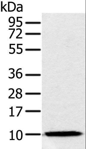 Polyclonal Rabbit anti-Human NDUFA2 Antibody (IHC, WB)