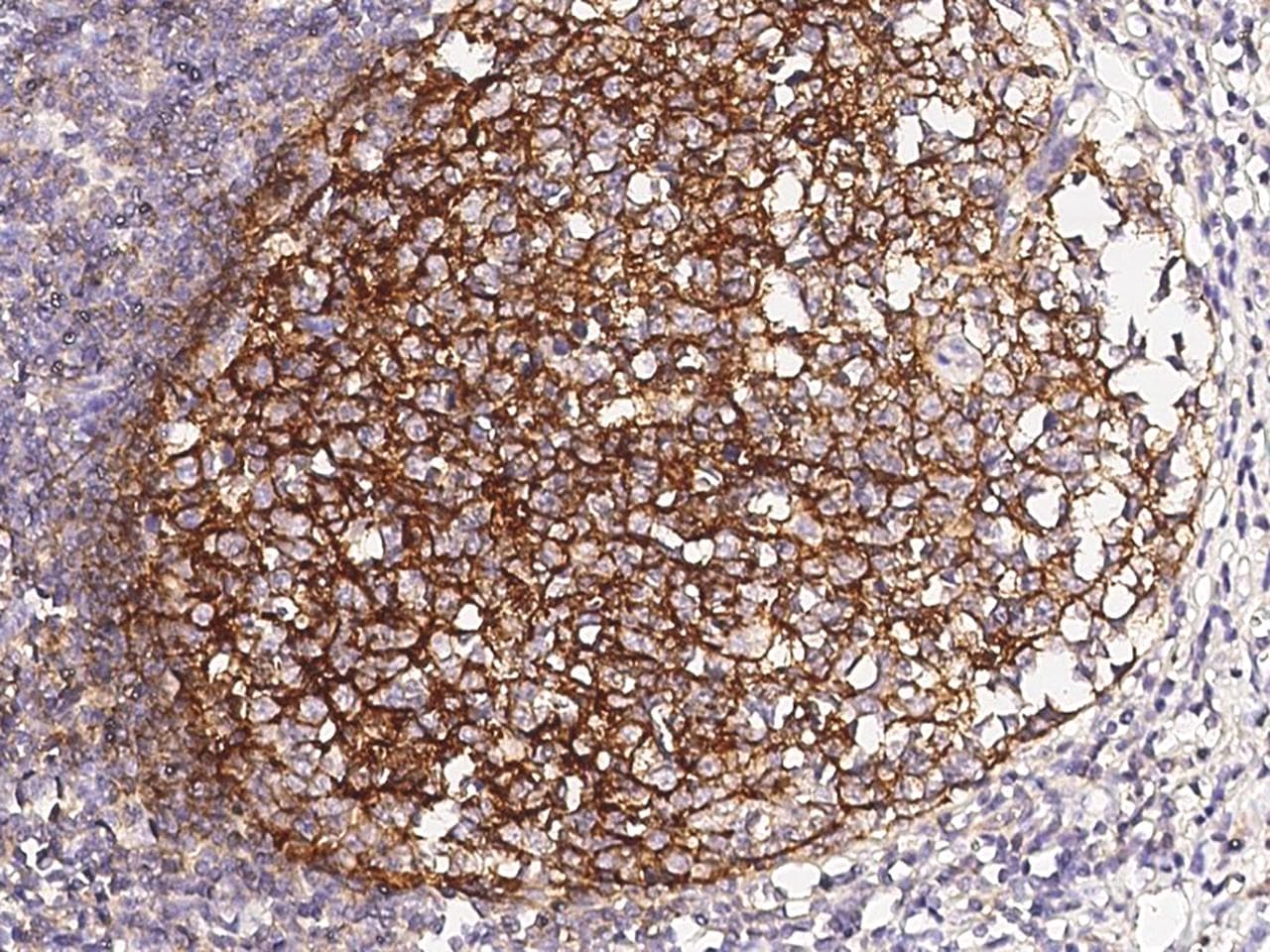 Monoclonal Mouse anti-Human CR2 / CD21 Antibody (clone 28, Preservative Free, IHC)