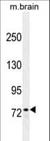 Monoclonal Mouse anti-Human ZFP37 Antibody (WB)