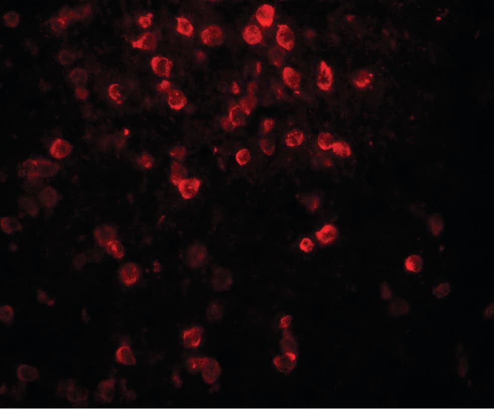 IL9 Antibody