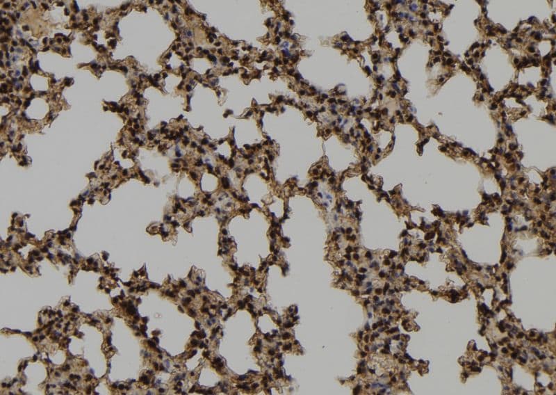 CHCHD2 Antibody