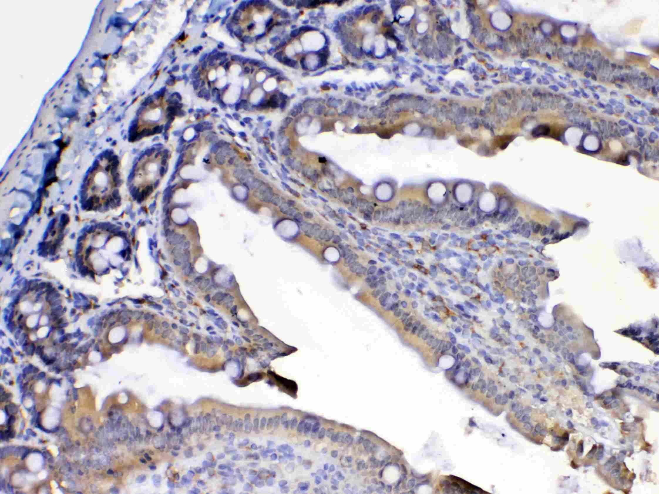 Polyclonal Rabbit anti-Mouse CD135 / FLT3 Antibody (IHC, WB)