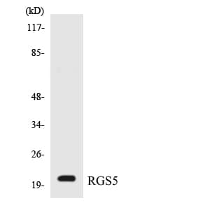 IHC-plus™ RGS5 Antibody (aa71-120)