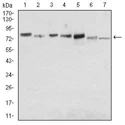 SDC1 / Syndecan 1 / CD138 Antibody (aa28-171, clone 1A3H4)
