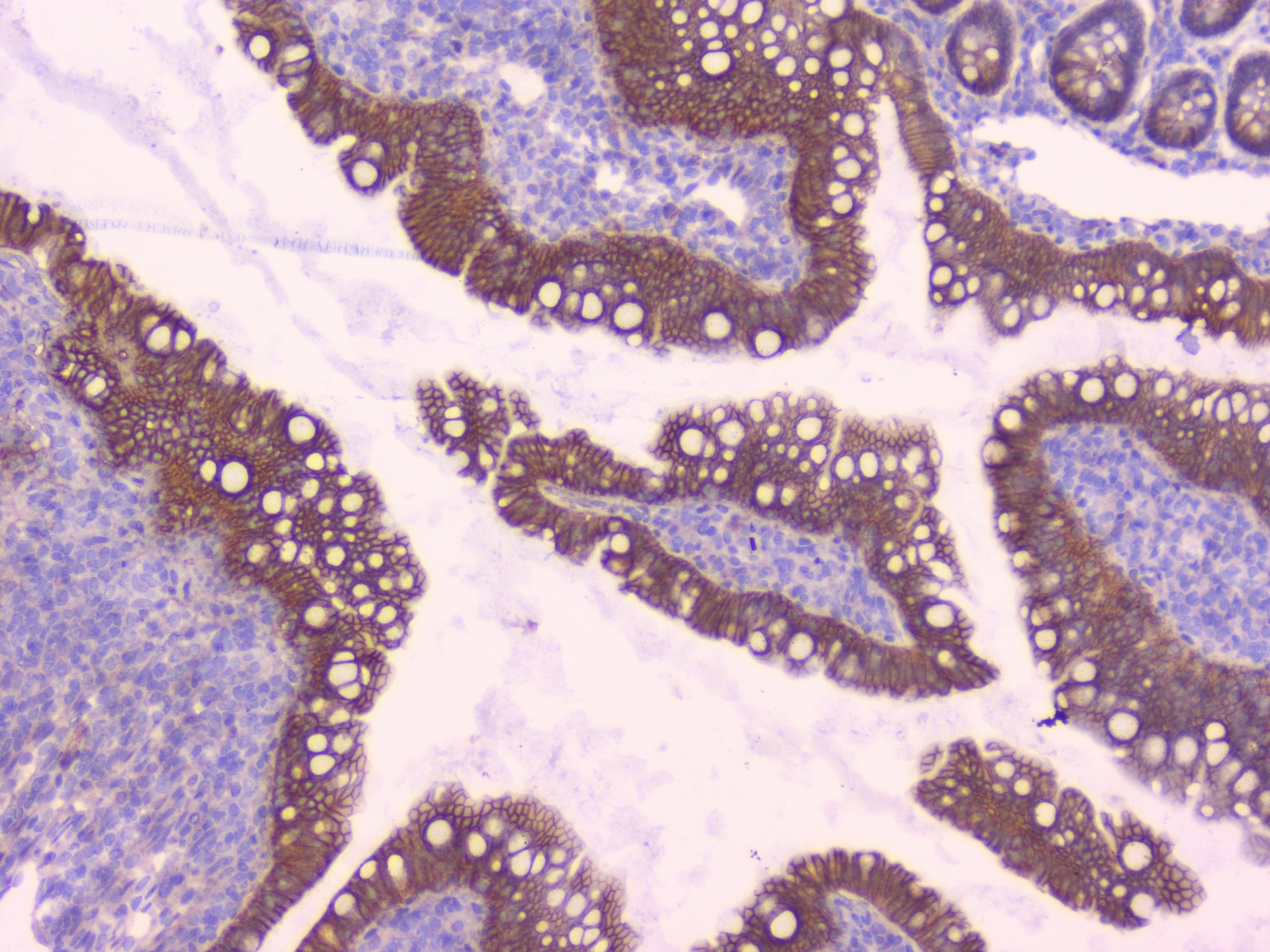 CTNNB1 / Beta Catenin Antibody