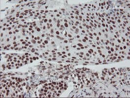 TPRKB Antibody (clone OTI3H3)