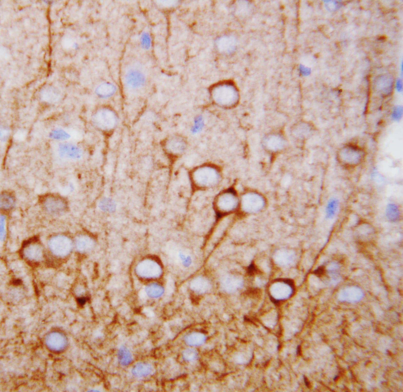 CAMKK1 Antibody (aa10-31)