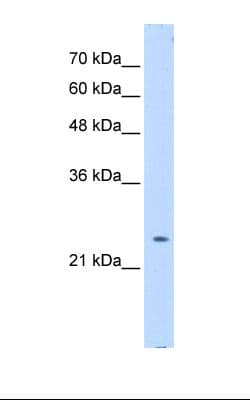 PTPN2 / TC-PTP Antibody (aa201-250)