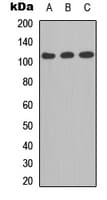 ITGA2B / CD41 Antibody (C-Terminus)