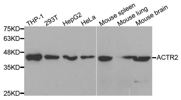 Polyclonal Rabbit anti-Human ACTR2 / ARP2 Antibody (IHC, IF, WB)