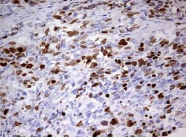 TOP2A / Topoisomerase II Alpha Antibody (aa1100-1531, clone 1D2, Carrier-free)