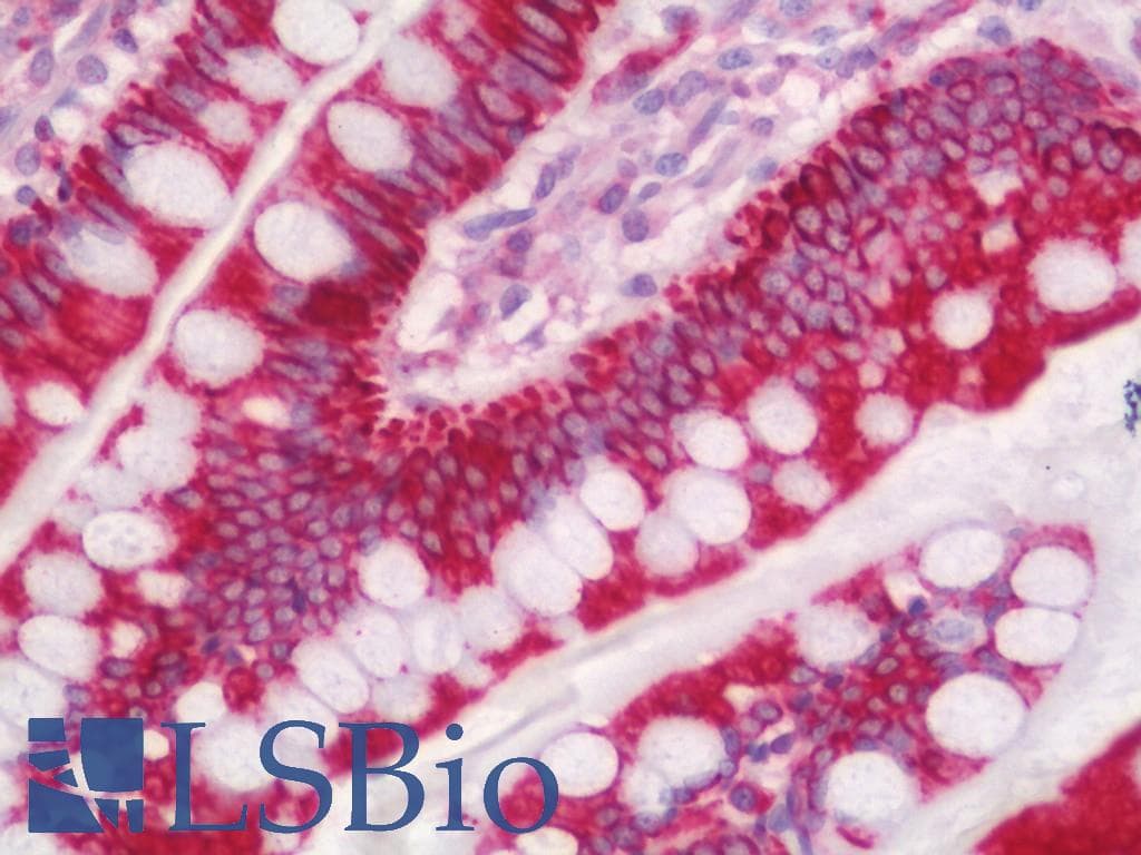 IHC-plus™ KRT19 / CK19 / Cytokeratin 19 Antibody (aa300-349)