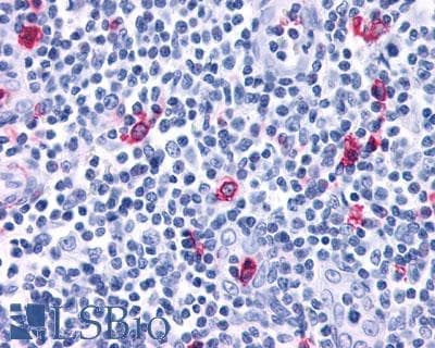 PathPlus™ Polyclonal Rabbit anti-Human CXCR3 Antibody (C-Terminus, IHC)