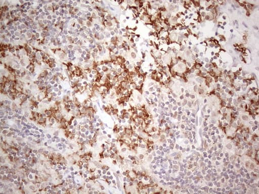 TNFSF5IP1 / CLAST3 Antibody (clone OTI1E8)