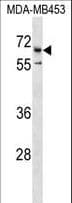 CATSPER2 Antibody (aa472-500)