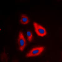 Tuberin / TSC2 Antibody (phospho-Thr1462)