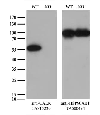 Monoclonal Mouse anti-Human CALR / Calreticulin Antibody (clone OTI6H10, WB)