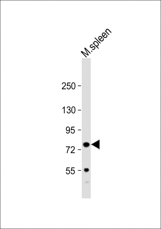 URP2 / FERMT3 Antibody (N-Terminus)