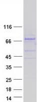 Human PIKFYVE / PIP5K Protein (Recombinant Myc-DDK (Flag))