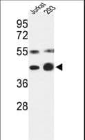 COPS3 / CSN3 Antibody (aa98-130)
