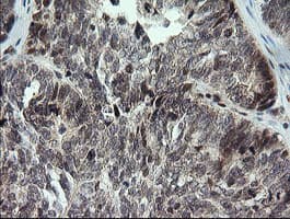 KIF25 Antibody (clone OTI2C9)