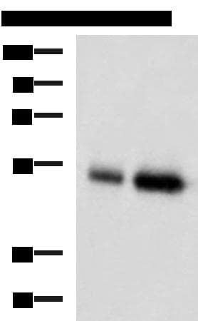 BMP5 Antibody