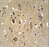 Polyclonal Rabbit anti-Human FA2H / FAAH Antibody (aa121-148, IHC, WB)