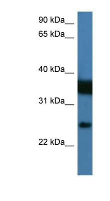 Polyclonal Rabbit anti-Human ZMAT2 Antibody (aa25-74, WB)