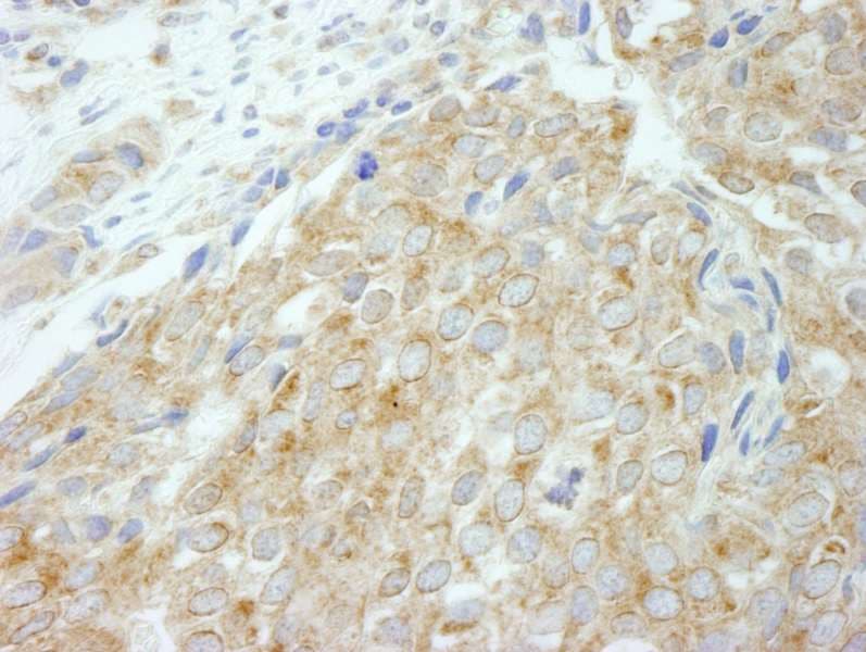 Polyclonal Rabbit anti-Human FLII / FLI Antibody (aa425-475, IHC, IF)