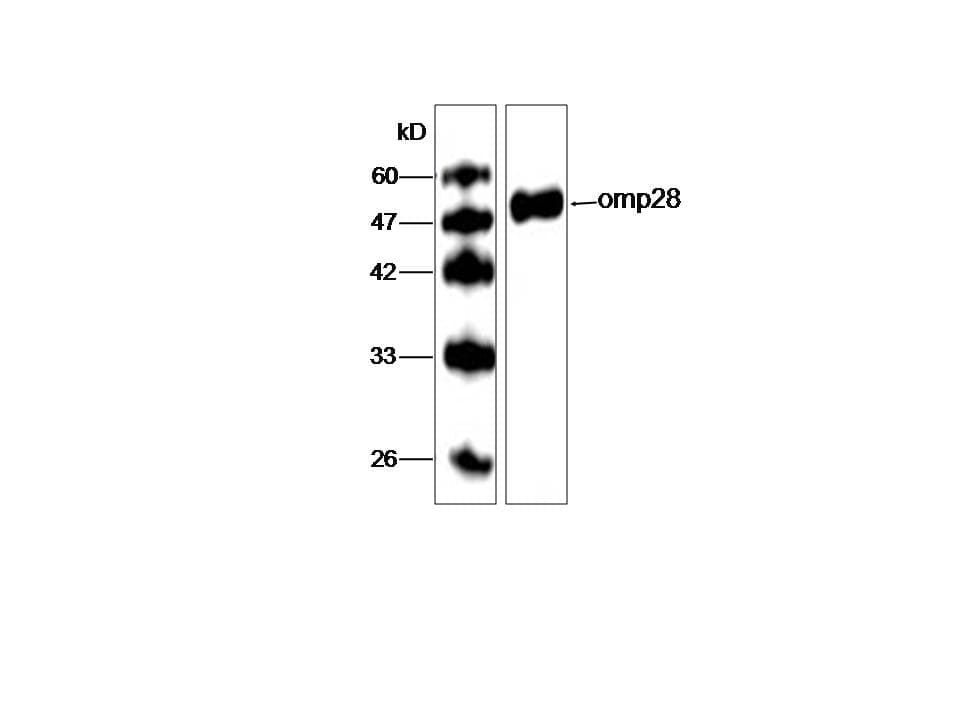 Monoclonal Mouse anti-Legionella pneumophila Legionella pneumophila omp28 Antibody (clone 59534-23, aa47-264, WB)