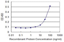 Monoclonal Mouse anti-Human PCK2 / PEPCK Antibody (clone 2C9, WB)