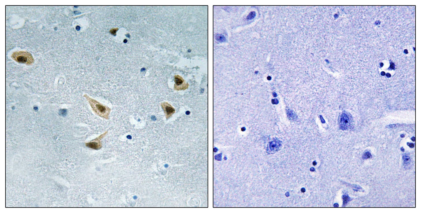 TP53 / p53 Antibody (phospho-Ser376)