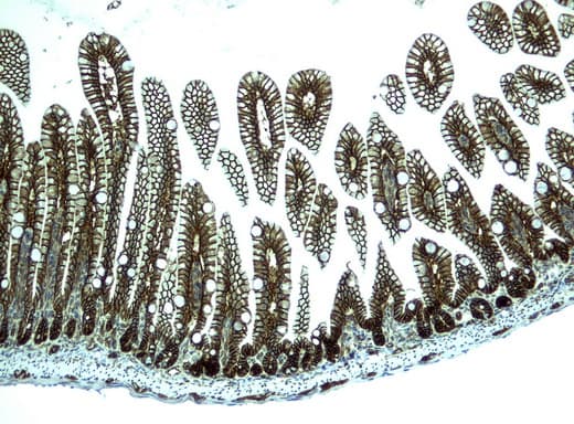 CTNNB1 / Beta Catenin Antibody (clone UMAB15)