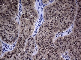 HSPD1 / HSP60 Antibody (clone OTI1B3)