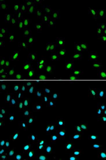 RFC1 / RFC Antibody