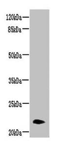 Polyclonal Rabbit anti-Human NRSN2 Antibody