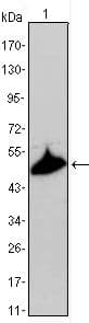 KRT15 / CK15 / Cytokeratin 15 Antibody (clone 60000000)