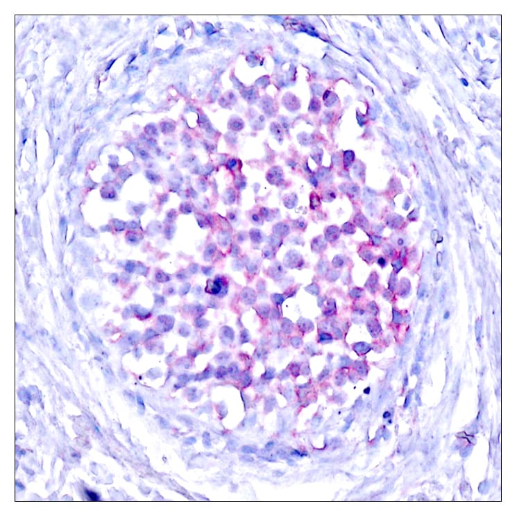 RAF1 / RAF Antibody (phospho-Ser259)