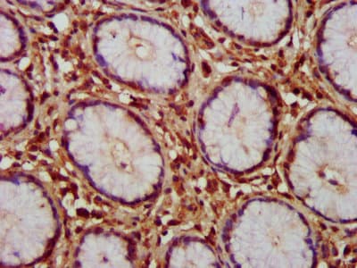 Polyclonal Rabbit anti-Human HAX-1 Antibody (IHC, WB)