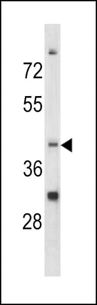 CCRN4L / Nocturnin Antibody (aa309-336)