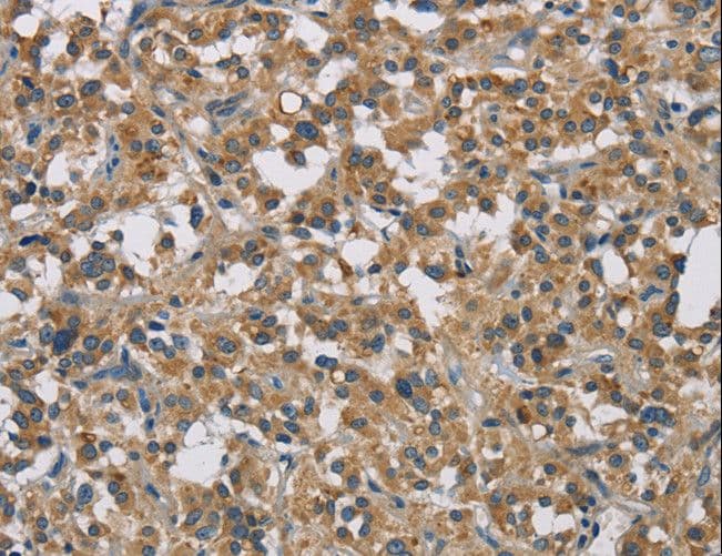 Polyclonal Rabbit anti-Human STAT4 Antibody (IHC)