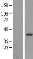 TRUB2 Protein (Over-Expression Lysate Myc-DDK (Flag))