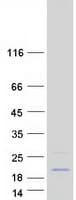 Human CCDC58 Protein (Recombinant Myc-DDK (Flag))