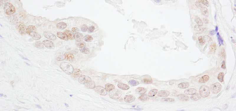Polyclonal Rabbit anti-Human HMGN3 Antibody (aa30-60, IHC)