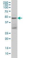 IHC-plus™ TSG101 Antibody (clone 5B7)