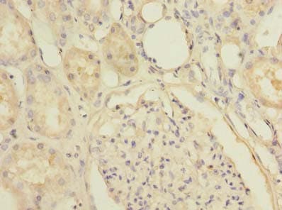 SLC25A36 Antibody