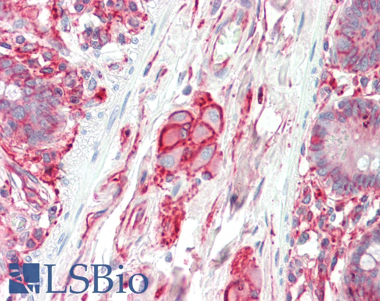IHC-plus™ Polyclonal Rabbit anti-Human SPTAN1 / Alpha Fodrin Antibody (IHC, IF, WB)