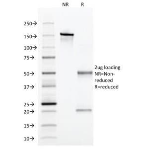 SERPINA1 / Alpha 1 Antitrypsin Antibody (clone AAT/1379)